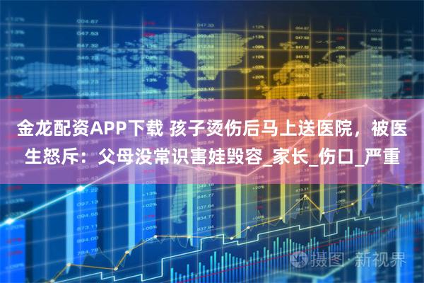金龙配资APP下载 孩子烫伤后马上送医院，被医生怒斥：父母没常识害娃毁容_家长_伤口_严重